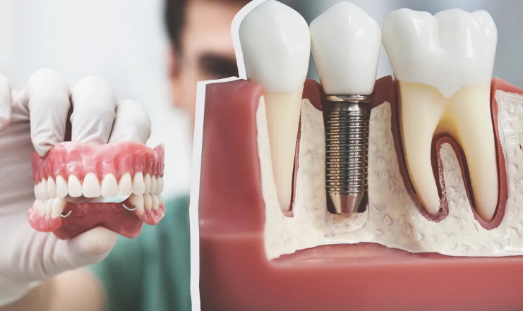 Способы восстановления зубов